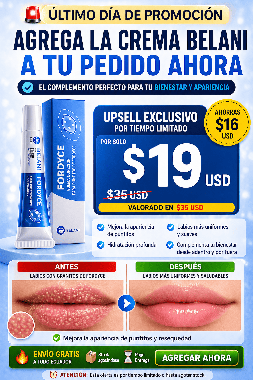 UPSELL CREMA BELANI